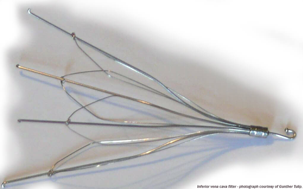 Inferior_vena_cava_filter 3